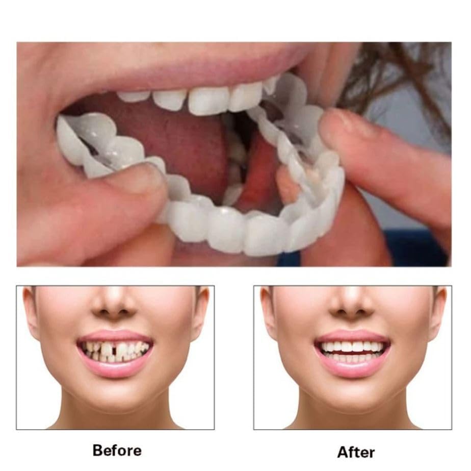 Snap-On Veneers – Reusable Fake Teeth Veneers, Nature-Like Comfort & Fit, Easy Hot-Water Molding, Instant Cover for Imperfect Smile – Regain Confidence - Image 4