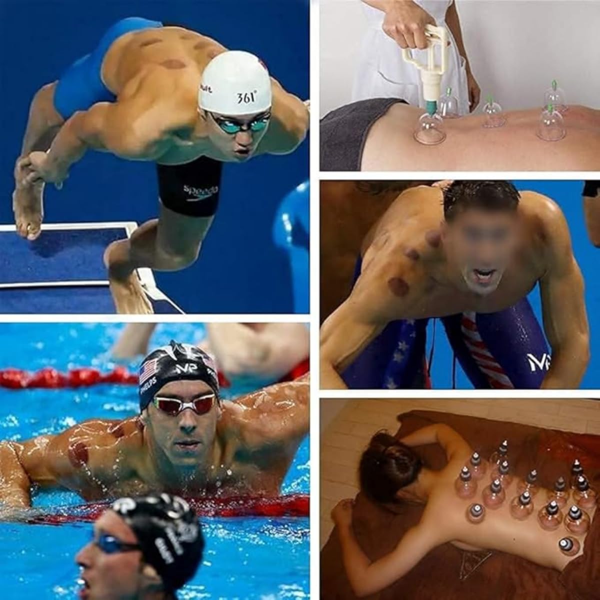 Cupping Therapy Set / 24-Piece Vacuum Suction Cups with Hand Pump, Magnetic Acupressure Points, Massage & Pain Relief Kit for Home & Professional Use - Image 7